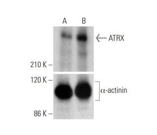 Atrx Crispr Knockout And Activation Products H Scbt Santa Cruz