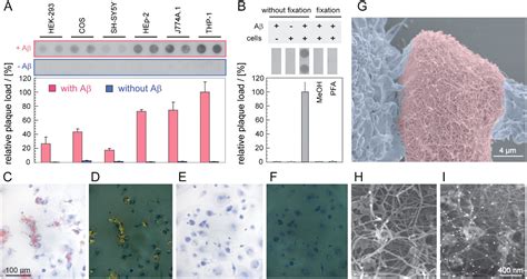 Mechanism Of Amyloid Plaque Formation Suggests An Intracellular Basis