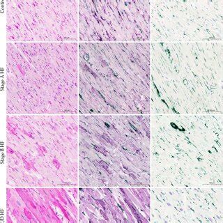 ACE2 protein expression in the human myocardium. Representative images ...