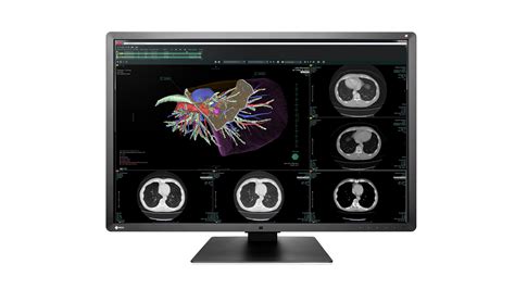 Diagnostische Monitoren Radiforce Rx Diagnostische Monitoren