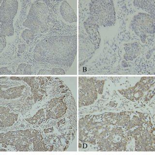 Representative Figures Of Immunohistochemical Ihc Staining For