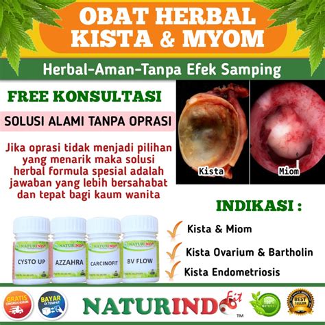 Jual Obat Kista Dan Miom Myom Herbal Coklat Kista Endometriosis Cysta