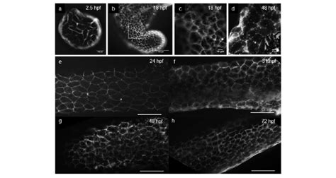 E Cadh Immunofluorescence Detection In Zebrafish Embryo Epidermis A