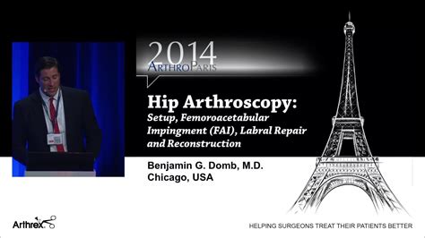 Arthrex Hip Arthroscopy Setup Femoroacetabular Impingement Fai