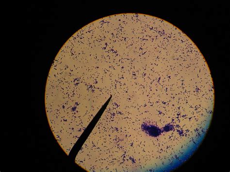 Escherichia Coli Simple Stained Smear 40x Minyoung Choi Flickr