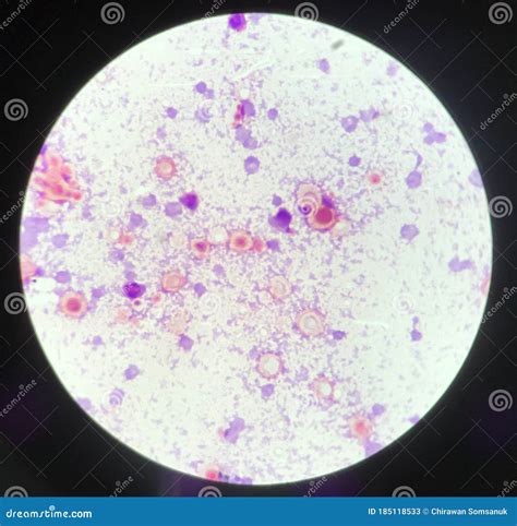 Yeast Cells Budding