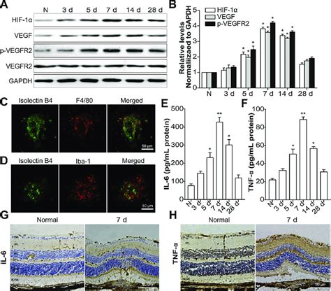 The levels of HIF 1α VEGF VEGFR2 pathway proteins and M1 type