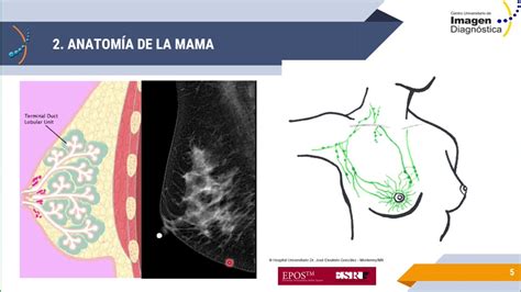 Imagenología De Glándula Mamaria Parte I Youtube