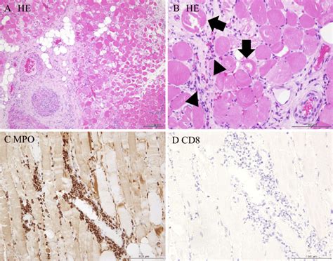 Figure A Hematoxylin And Eosin H E Staining Section Of