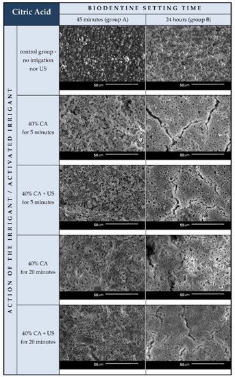 The Effect Of Irrigation With Citric Acid On Biodentine Tricalcium Silicate Based Cement Sem