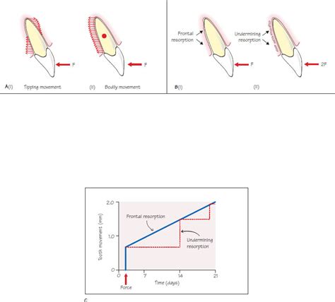 35 The Biology Of Tooth Movement Pocket Dentistry