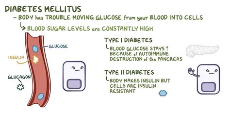 Diabetes Mellitus Clinical Practice Osmosis