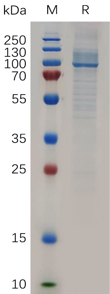 Human Hsp Aa Protein His Tag