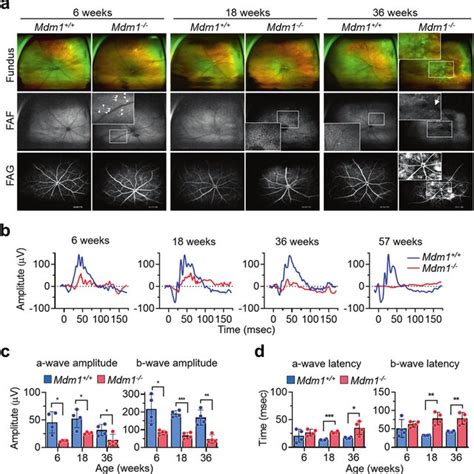 Retinal Phenotypes Of Mdm1 And Mdm1 −− Mice A Representative