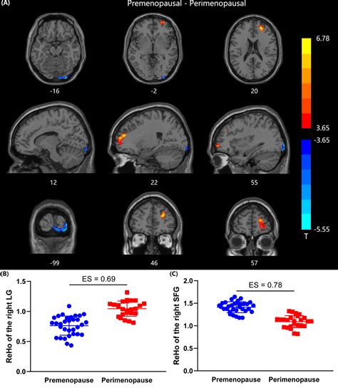 Frontiers Altered Spontaneous Brain Activity In Women During