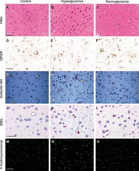 Illustration Of Neuropathological Findings And Oxidative Stress In The