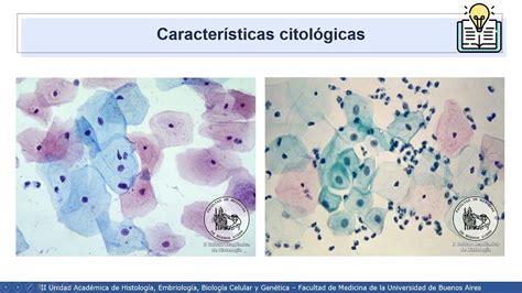 VIDEHISTO 57 Sistema Reproductor Femenino Cuello Uterino Y PAP