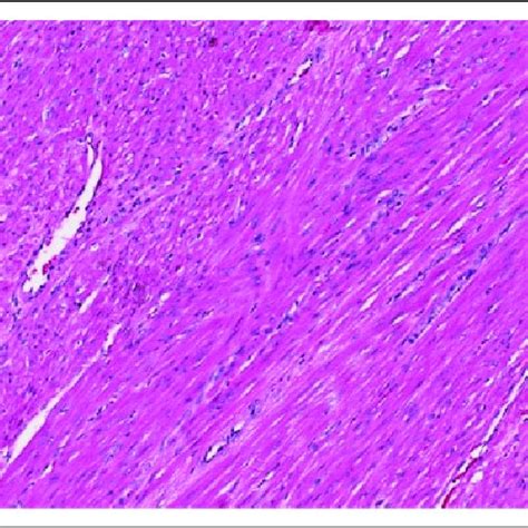 Normal Myometrium Hematoxylin And Eosin Stain Original Magnification