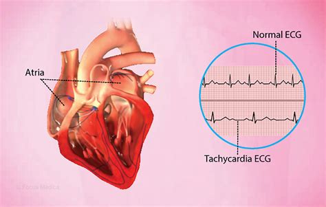 Health Condition Symptoms Causes Treatment And More