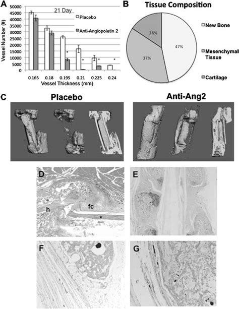 Anti Angiopoietin 2 L1 10 Treatment Inhibits Large Vessel