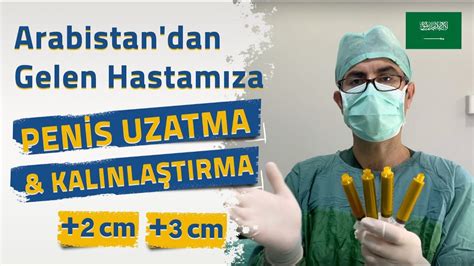 Arabistan dan Gelen Misafirimize Penis Uzatma 2 cm Kalınlaştırma