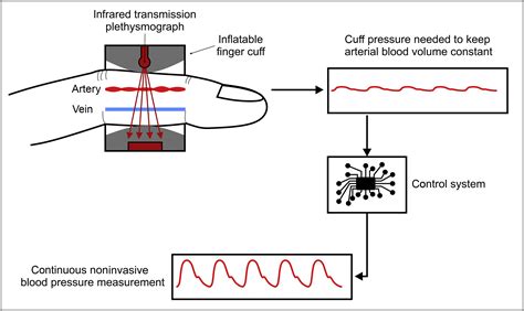 Continuous Noninvasive Pulse Wave Analysis Using Finger Cuff