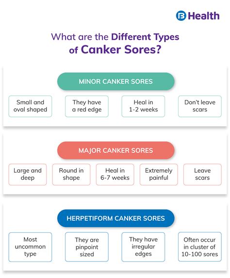 Canker Sores Treatments Causes And Symptoms