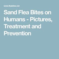 11 Best sand fleas ideas | sand fleas, fleas, sand