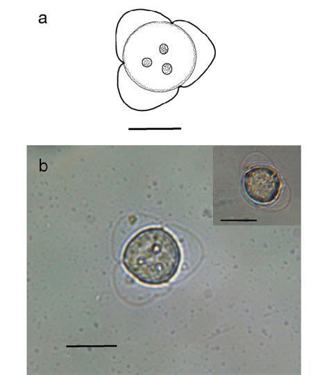 Neoactinomyxum Type JD A Line Drawing Of Mature Actinospore B
