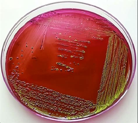 Greenish Metallic Sheen Producing Colonies Of E Coli On Eosin