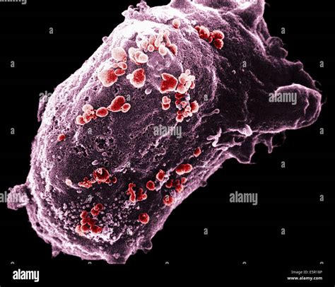 Scanning Electron Micrograph Sem Of A Lymphocyte With Hiv Cluster