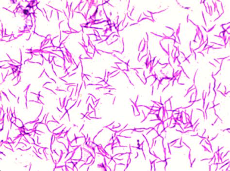 Gram Negative Bacillus Gram Stain Stock Image Image O