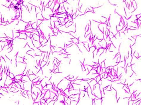 Photomicrograph showing Gram-negative fusiform bacilli of... | Download Scientific Diagram