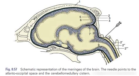 Meninges Atlanto Occipital Space Cerebellomedullary Cistern Diagram