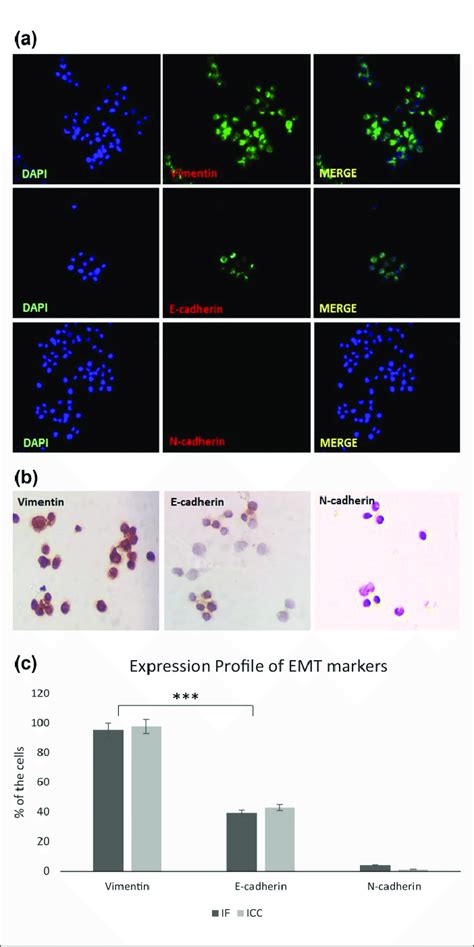 Expression Of EMT Markers Vimentin E Cadherin And N Cadherin In