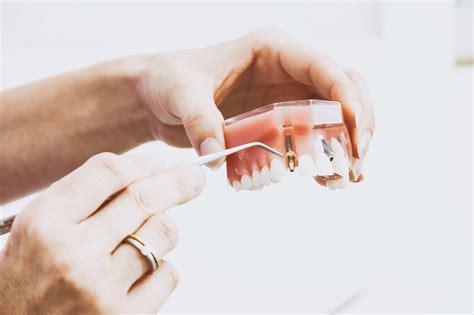 Cirugía Periodontal Regenerativa Conoce sus Ventajas y Desventajas