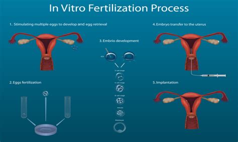 Navigating Ivf A Comprehensive Guide To In Vitro Fertilization Success