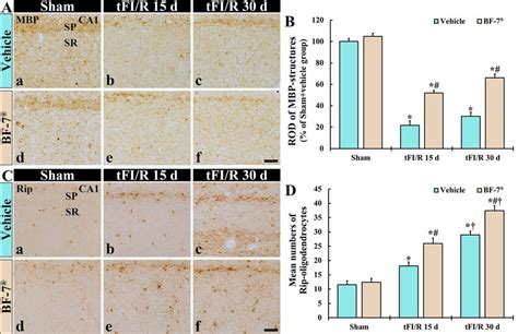 Changes In Myelination And Oligodendrocytes In The Hippocampal Ca