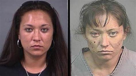 18 Disturbing Before And After Pictures Of Faces Transformed By Drug