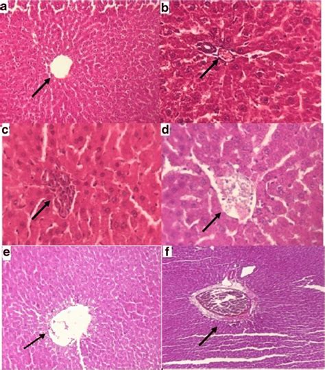 Photomicrographs Of Hematoxylin And Eosin Hande Stained Sections Of The