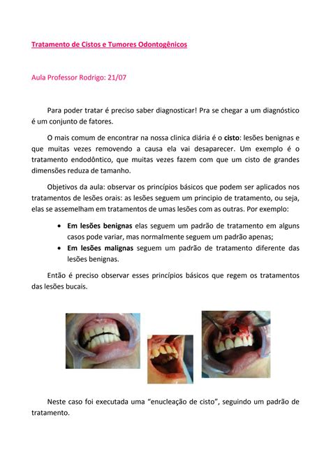 SOLUTION Tratamento De Cistos E Tumores Odontog Nicos Studypool