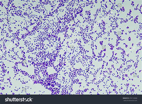 Gram Positive Cocci Bacteria Microbiology Stock Photo