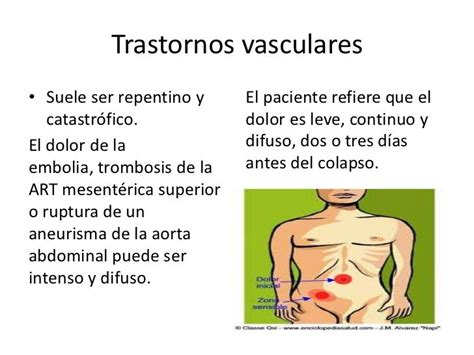 Dolorabdominal