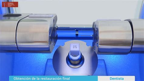 Cadcam Reconstrucción De Diente Con Restauración Onlayinlay Youtube