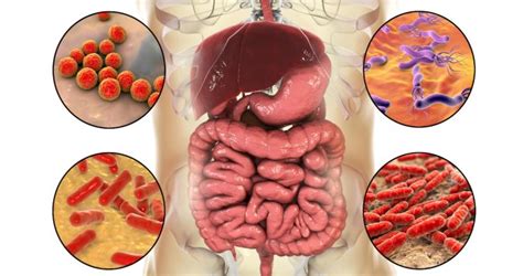 Se Ales Que Te Ayudar An A Identificar Si Tienes Tu Flora Intestinal Da Ada