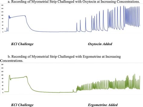 Effects Of Maternal Parity On Response Of Human Myometrium To Oxytocin