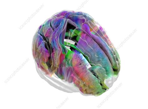 White Matter Fibres DTI MRI Scan Stock Image C058 1561 Science