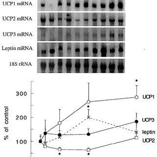 Northern Blotting Analysis Of MRNAs For UCP1 UCP2 UCP3 And Leptin In