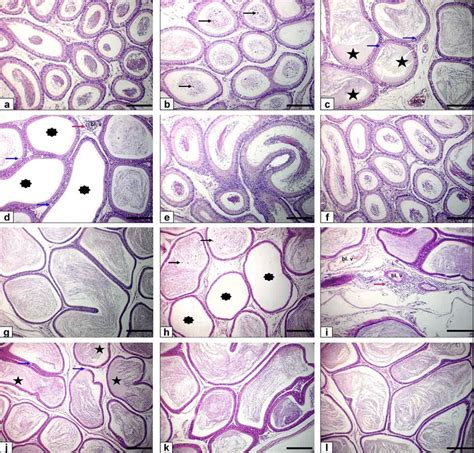 Photomicrograph Of Rat Epididymis Stained With He Bar 100 µm A F