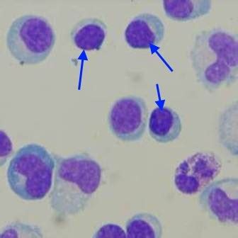 WBC Morphology Changes Flashcards Quizlet